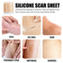 Silicone Scar Repair Patch