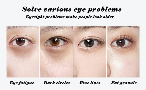 60pcs Gold Collagen Eye Masks – Moisturizing, Anti-Dark Circles & Eye Bags