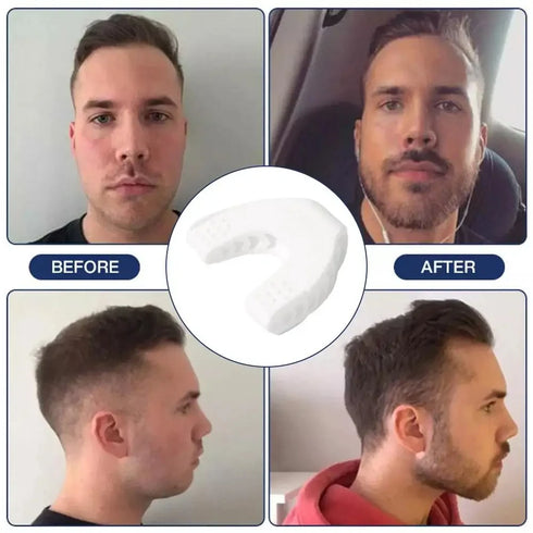 Jawline Exerciser & Neck Toning Trainer