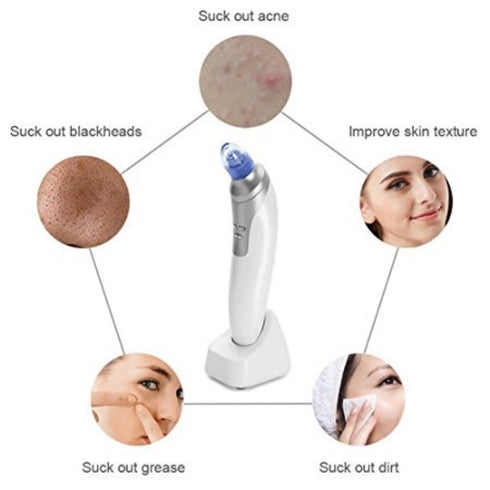 Blackhead Remover Device